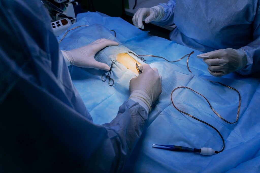 Doctors getting read to perform a Exploratory Laparotomy